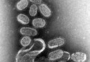 Historia odkrycia wirusa grypy i wprowadzenia pierwszej przeciwgrypowej szczepionki